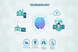 Teleradiology Explained How It Differs from Traditional Radiology - Created by PostDICOM